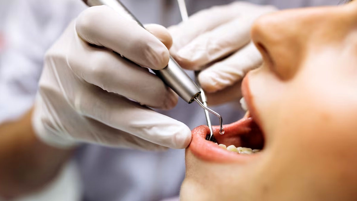 root-canal-treatment
