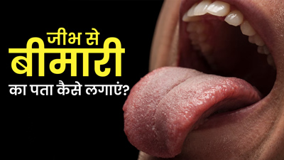 जीभ देखकर भी लगाया जा सकता है बीमारी का पता, जानें कैसे 