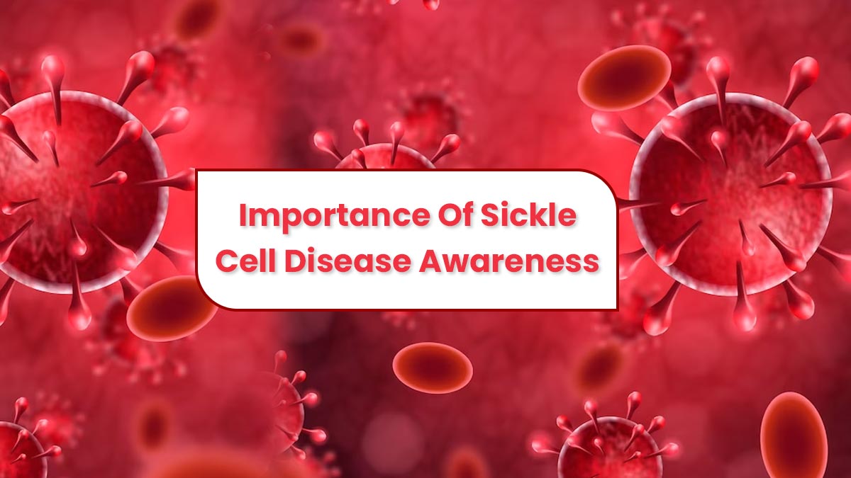 اليوم العالمي للخلايا المنجلية 2023: موضوع وأهمية وأهمية للتوعية بالخلايا المنجلية