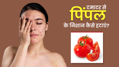 टमाटर से हटाएं मुंहासों के जिद्दी निशान, इन 4 तरीकों से करें इस्तेमाल