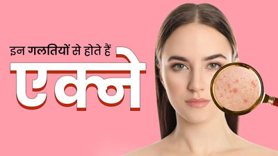इन 5 गलतियों की वजह से हो सकते हैं बार-बार एक्ने, आज ही छोड़ें