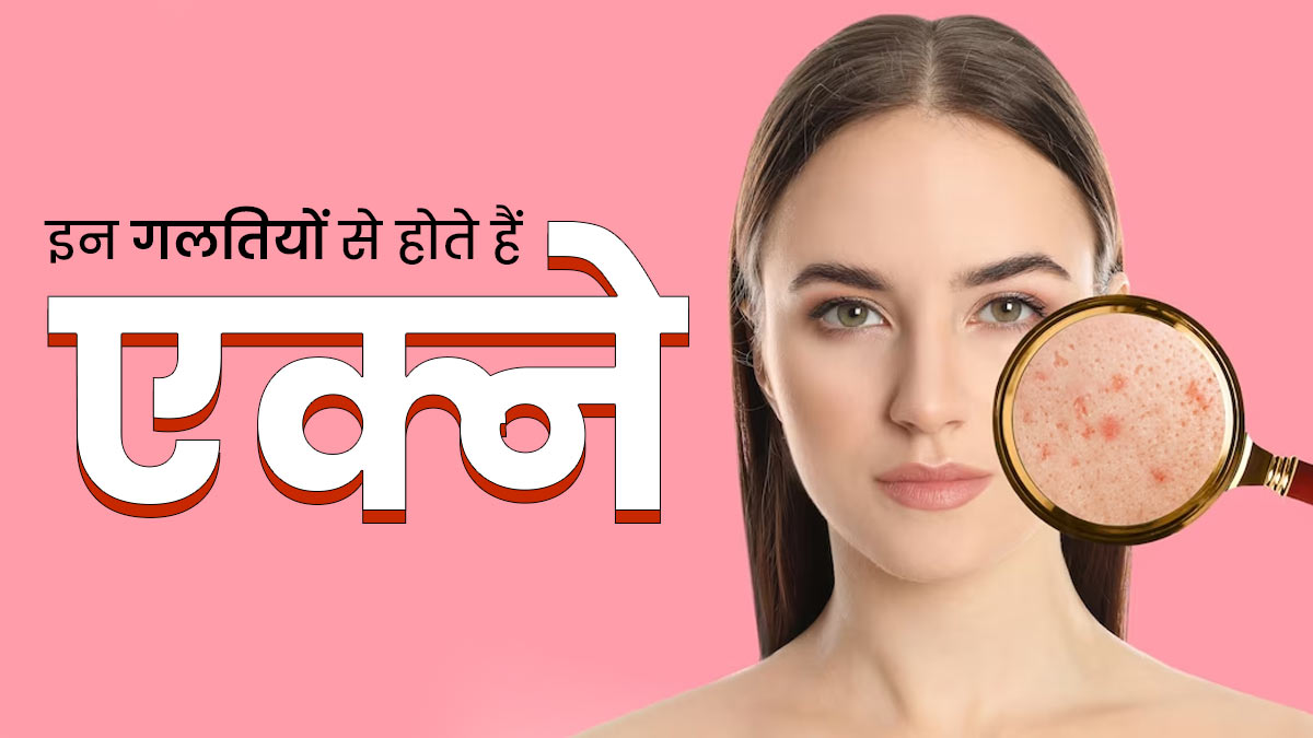 इन 5 गलतियों की वजह से हो सकते हैं बार-बार एक्ने, आज ही छोड़ें