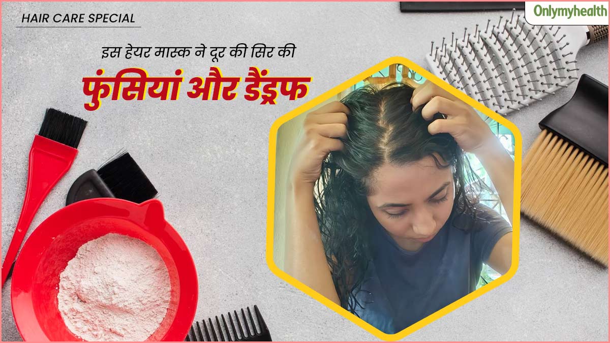 सिर में डैंड्रफ और फुंसियों से परेशान थीं अंतरा, इस घरेलू उपाय से दूर हुई स्कैल्प से जुड़ी समस्याएं