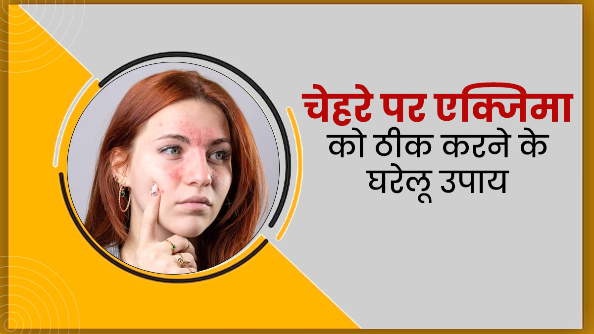 चेहरे पर एक्जिमा हो जाए तो अपनाएं ये घरेलू उपाय, खुजली और रेडनेस से मिलेगी राहत