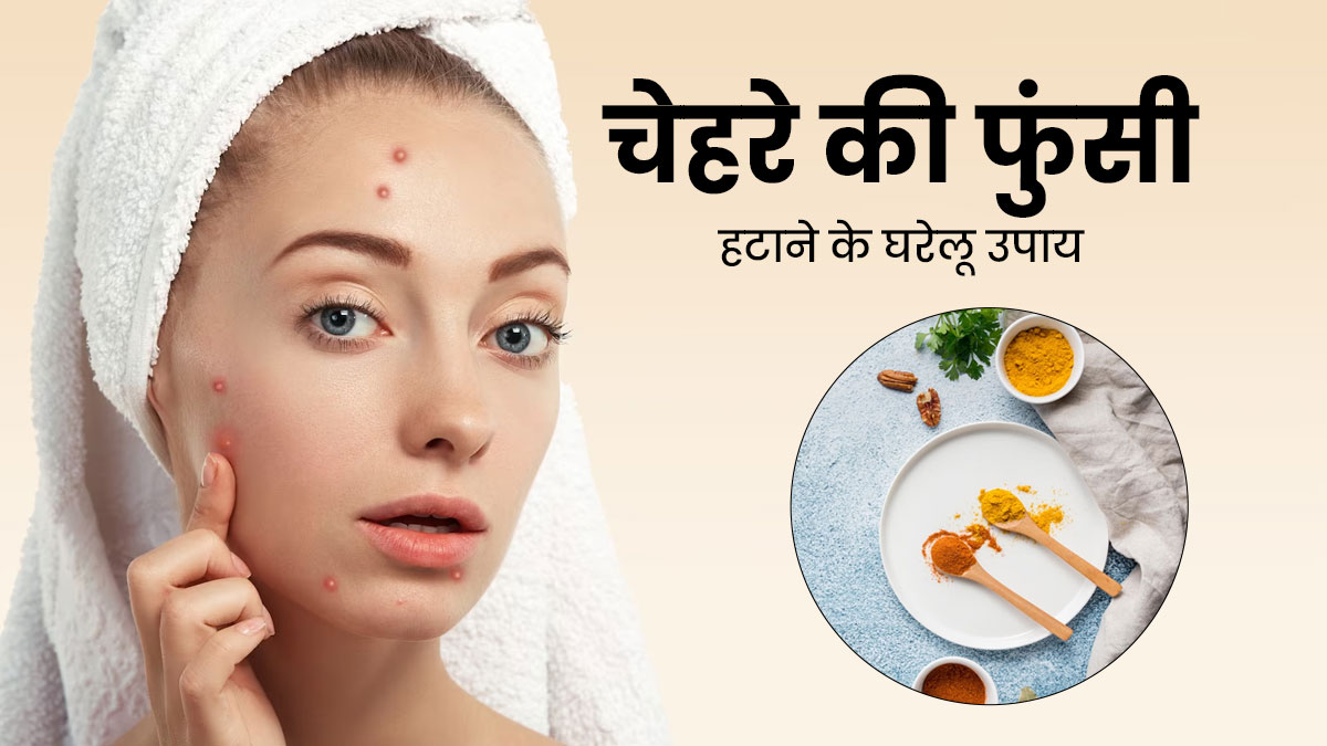 चेहरे पर हो गई है फुंसी? अपनाएं ये 5 घरेलू उपाय, जिनसे मिटने लगेंगे पिंपल्स