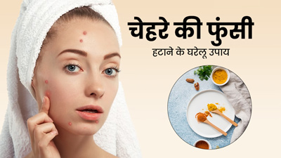चेहरे पर हो गई है फुंसी? अपनाएं ये 5 घरेलू उपाय, जिनसे मिटने लगेंगे पिंपल्स