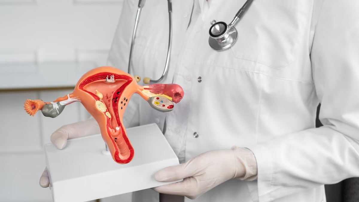 Is PCOD A Risk For Diabetes? Doctor Explains In Detail