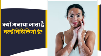 World Vitiligo Day 2024: 25 जून को ही क्यों मनाया जाता है विश्व विटिलिगो दिवस? जानें इस दिन का इतिहास और थीम