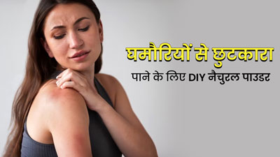 गर्मियों में चुभती घमौरियों से परेशान हैं, तो लगाएं ये 5 DIY नैचुरल पाउडर