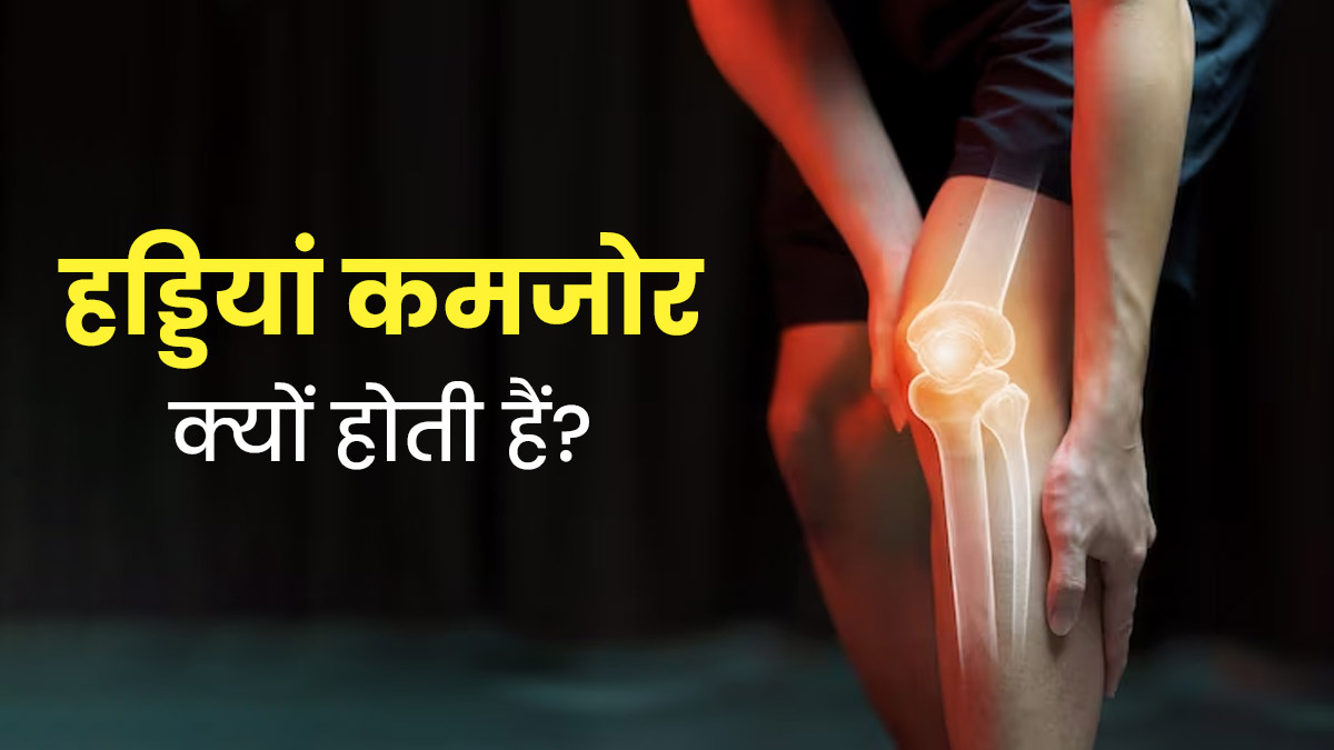 ओस्टियोआर्थराइटिस रोग क्यों होता है? डॉक्टर से आसान भाषा में जानें इसके कारण