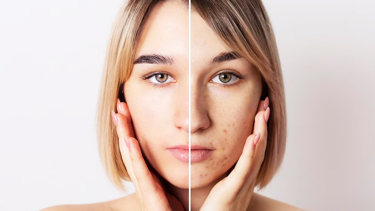 Baking Soda And Lemon Juice To Remove Dark Spots in hindi