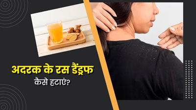 डैंड्रफ से छुटकारा पाने के लिए इस तरह करें अदरक के रस का प्रयोग, कई समस्याएं होंगी दूर