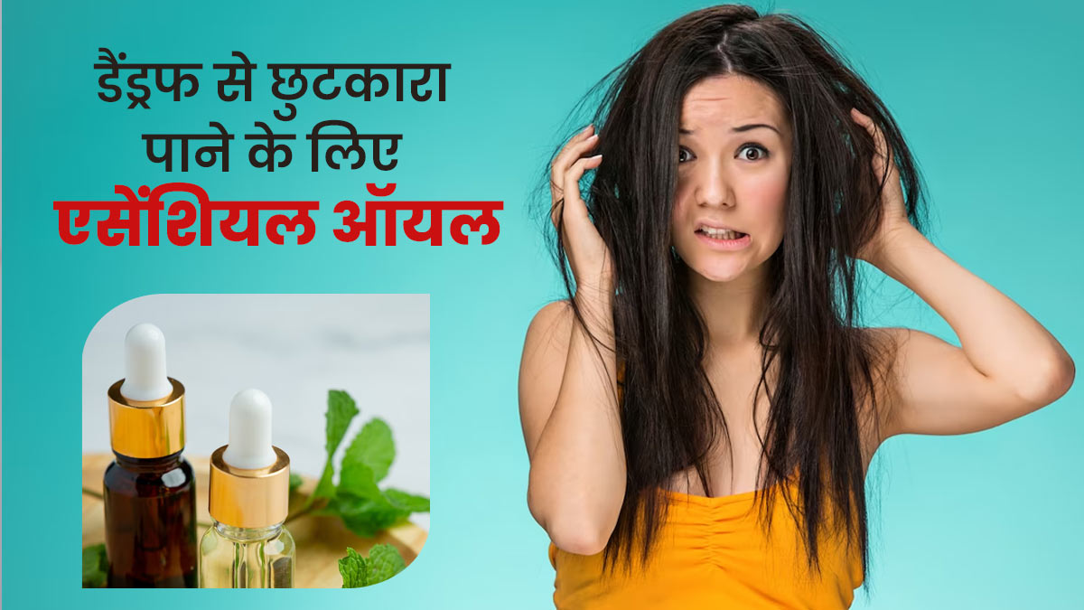 डैंड्रफ से छुटकारा पाने के लिए लगाएं ये 5 एसेंशियल ऑयल्स, स्कैल्प की खुजली भी होगी दूर
