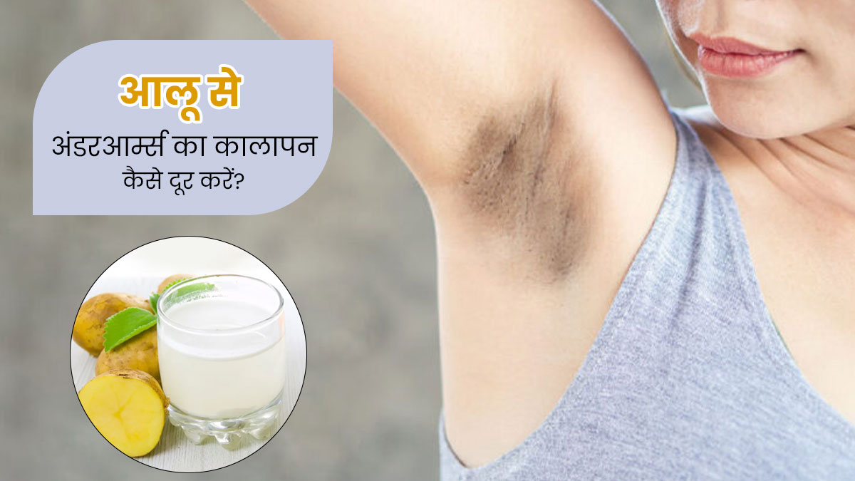 अंडरआर्म्स का कालापन दूर करने के लिए इन 4 तरीकों से करें आलू का इस्तेमाल