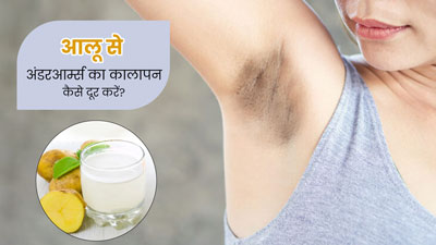 अंडरआर्म्स का कालापन दूर करने के लिए इन 4 तरीकों से करें आलू का इस्तेमाल
