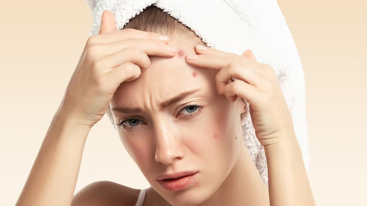 माथे पर रैशेज क्यों हो जाते हैं? जानें इसके कारण और बचाव के उपाय what