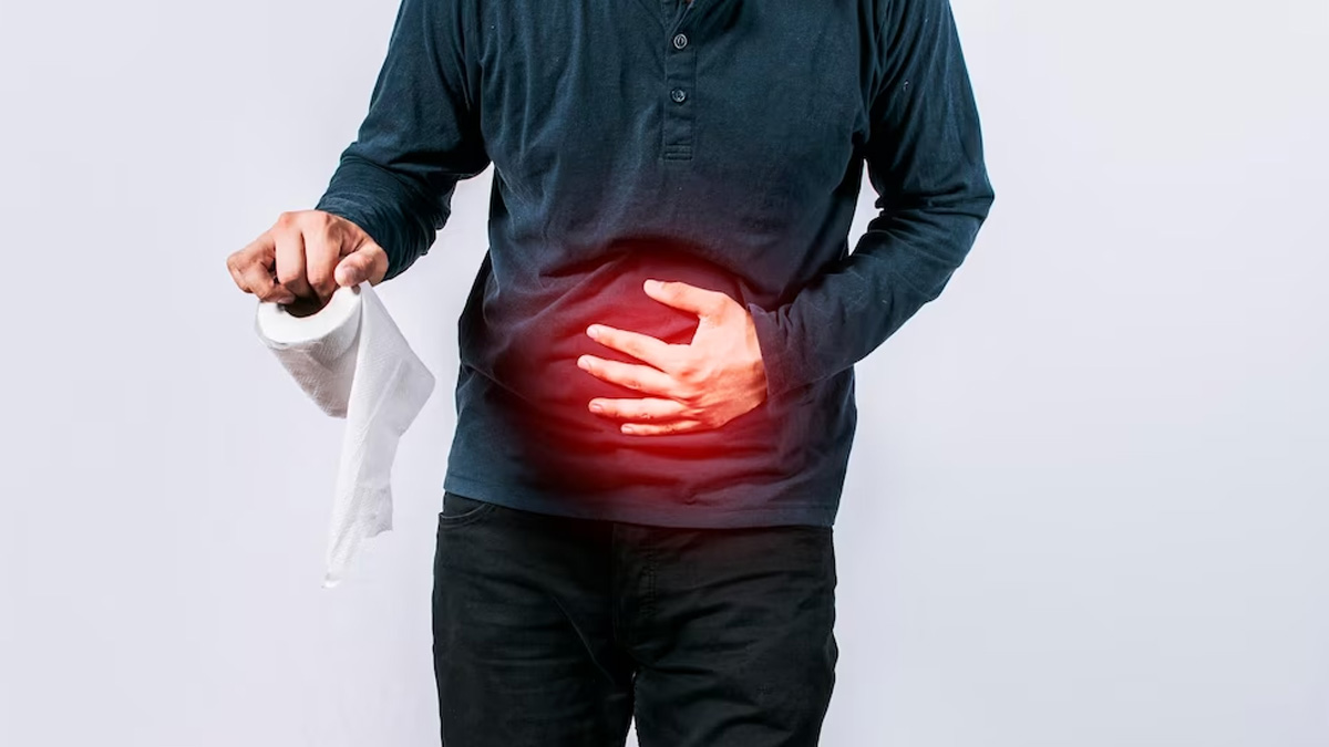 remedies for constipation
