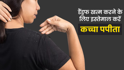 डैंड्रफ की समस्या दूर कर देगा कच्चा पपीता, ऐसे करें इस्तेमाल