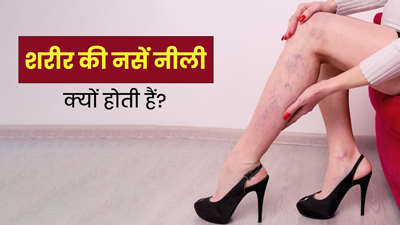 Visible Blue Veins Causes: शरीर पर क्यों दिखाई देने लगती हैं नीली नसें? डॉक्टर से जानें इसके कारण 