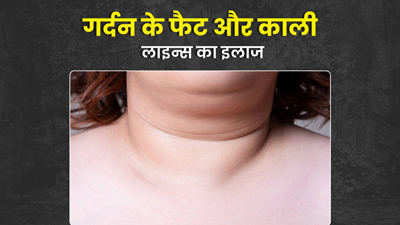 गर्दन पर जमा फैट और काली लाइन्‍स से पाना है छुटकारा, तो करें ये 5 उपाय