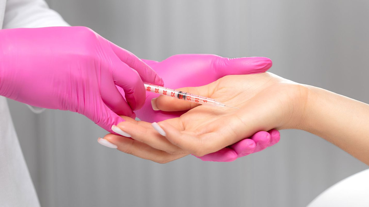 Sweating on Palm and Soles