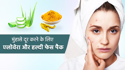 मुंहासे दूर करने के लिए एलोवेरा और हल्दी से बनाएं फेस पैक, डार्क स्पॉट्स से भी मिलेगा छुटकारा