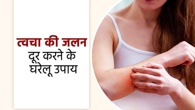त्वचा की जलन दूर करने के लिए आजमाएं ये 5 घरेलू उपाय, जल्द मिलेगी राहत