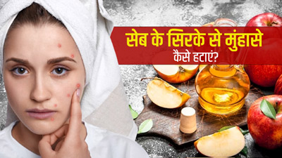 सेब के सिरके से चेहरे के मुंहासे कैसे हटाएं? जानें 4 तरीके और पाएं साफ-निखरी त्वचा