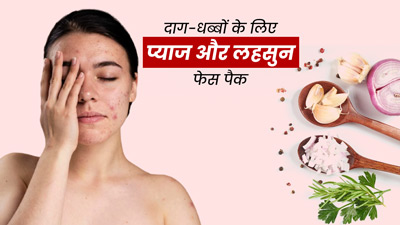 दाग-धब्बे दूर करने के लिए लगाएं प्याज और लहसुन फेस पैक, त्वचा में आएगा नैचुरल ग्लो