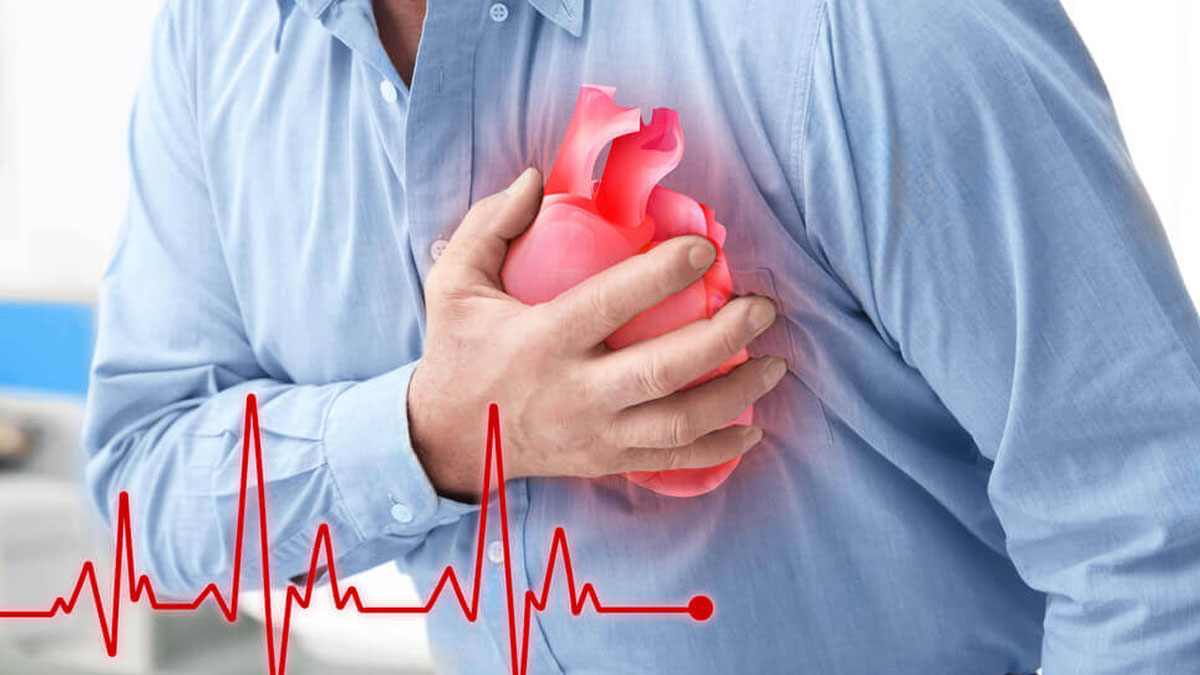heart attack in yound adults