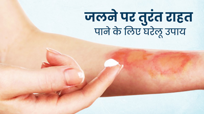 जलने पर तुरंत राहत पाने के लिए आजमाएं ये 5 घरेलू उपाय