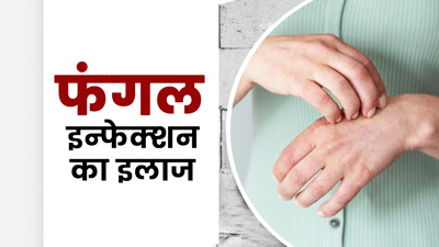 Fungal Infection: फंगल इंफेक्शन का इलाज है दालचीनी का तेल, जानें इस्‍तेमाल का तरीका