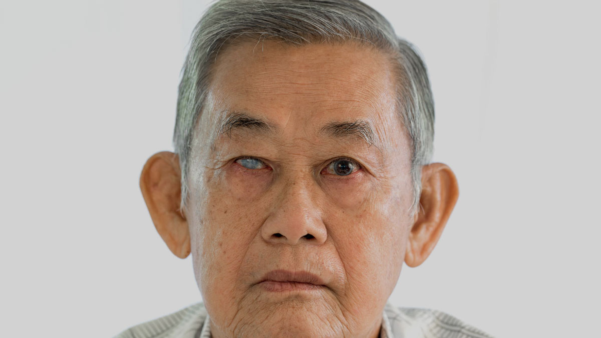 glaucoma week