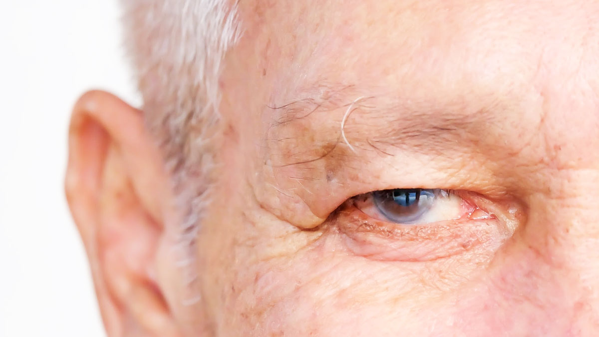 is glaucoma reversible