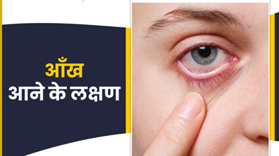 Conjunctivitis Symptoms: आँख आने (कंजंक्टिवाइटिस) के इन लक्षणों को सामान्य समझकर न करें नजरअंदाज