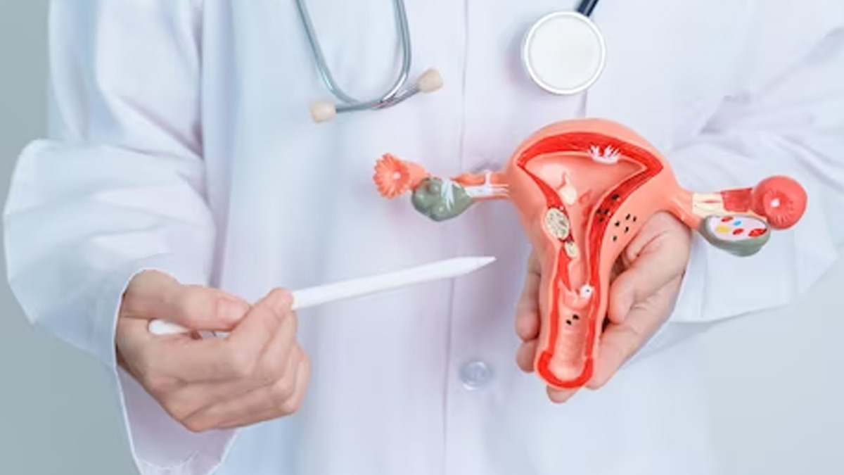 fibroids-affect-fertility