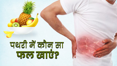 पथरी के मरीज इन फलों का करें सेवन, कई परेशानियां रहेंगी दूर