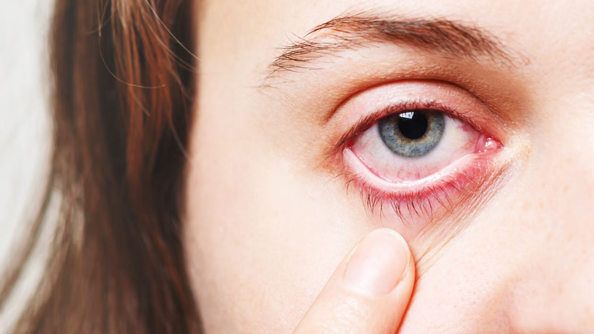 Foods Not To Eat With Glaucoma