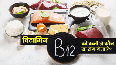 विटामिन बी12 की कमी से बढ़ता है इन 5 बीमारियों का खतरा, लक्षणों को न करें अनदेखा