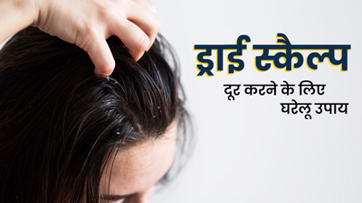 ड्राई स्कैल्प के कारण झड़ रहा है ड्रैंड्रफ? जानें स्कैल्प की ड्राईनेस दूर करने के 5 घरेलू उपाय