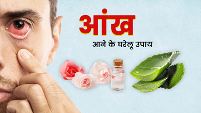 आंख आने (कंजंक्टिवाइटिस) पर अपनाएं ये 5 घरेलू नुस्खे, जल्द मिलेगा आराम