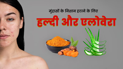 मुंहासों के निशान हटाने के लिए इस तरह लगाएं हल्दी और एलोवेरा, दूर होंगे दाग-धब्बे