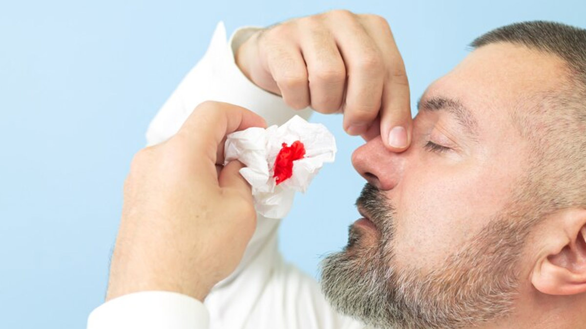 7-tips-to-prevent-nose-bleeds-in-summer