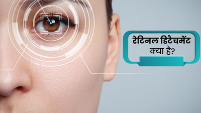 रेटिनल डिटैचमेंट के कारण चली जाती है आंखों की रोशनी, जानें क्यों होती है ये समस्या