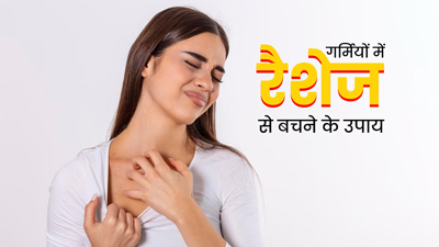 Sweat Rashes: गर्म‍ियों में पसीने से हो जाते हैं रैशेज? बचाव में काम आएंगी ये 5 ट‍िप्‍स