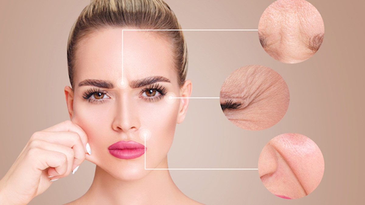 wrinkles causes on face
