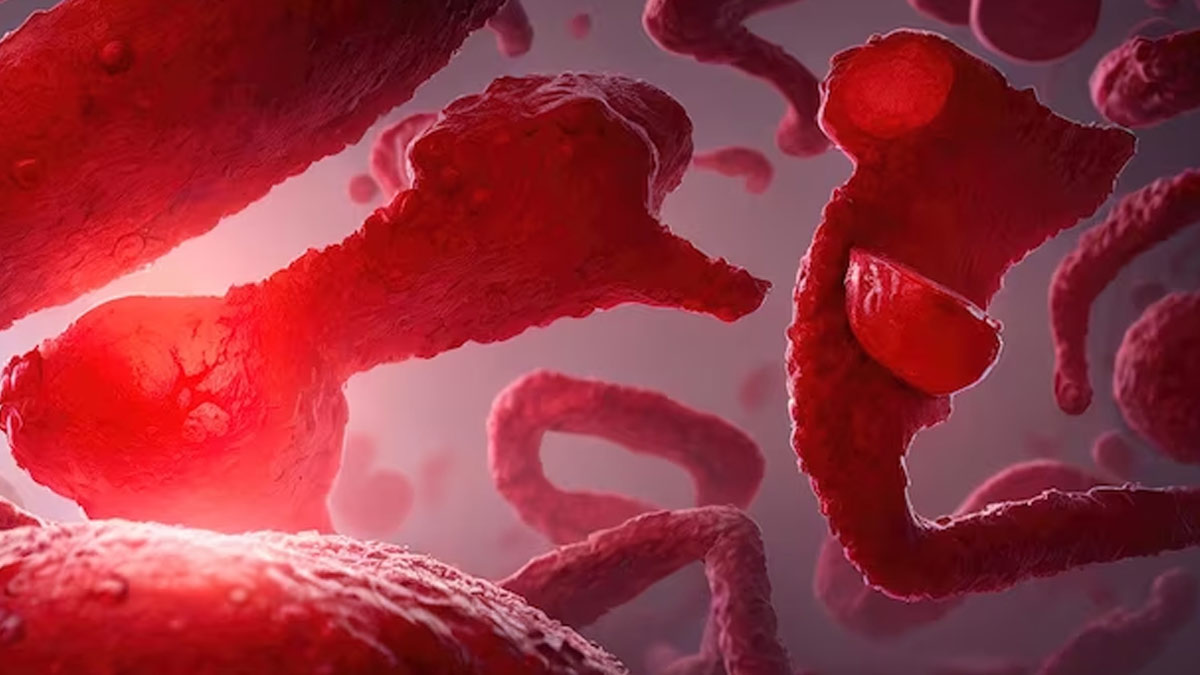 Blood-Cancer