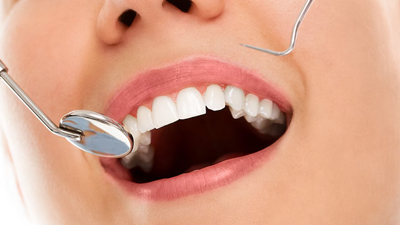 World Oral Health Day: इन 4 बीमारियों की वजह बन सकती है खराब ओरल हेल्थ, एक्सपर्ट से जानें इनके बारे में