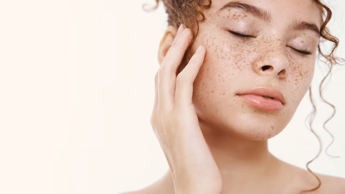  Dark Spots On Skin During Summers: Here’s How You Can Prevent Hyperpigmentation