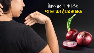 डैंड्रफ से छुटकारा पाने के लिए लगाएं प्याज से बने ये 3 हेयर मास्क, हेयर फॉल भी होगा कंट्रोल